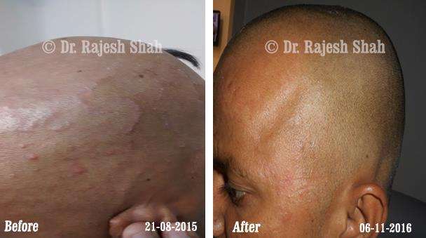 lifeforce homeopathy case-photos